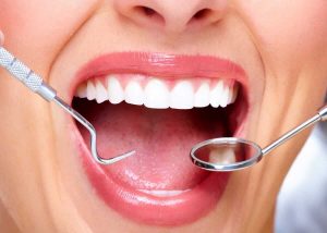 علاج اصفرار الاسنان طبيعيا