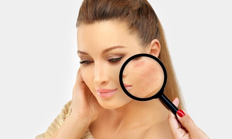 خطوات إخفاء الكدمات بالمكياج